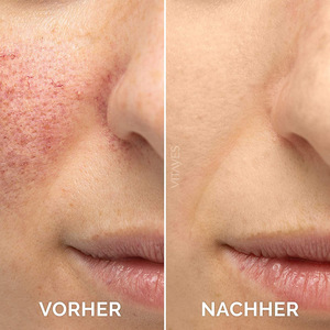 Nhãn hiệu riêng chăm sóc da chống nhăn làm trắng sáng Hydra nuôi dưỡng nhăn sâu sửa chữa Vitamin C huyết thanh - Product Image 3