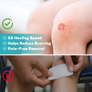 Pansement hydrocolloïde stérile auto-adhésif de qualité médicale, très absorbant, extra large, taille OEM, certifié CE, en rouleau, imperméable - Product Image 4