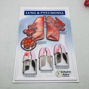 Lo studente umano i polmoni che insegna <span class=keywords><strong>3D</strong></span> Poster medico personalizzato Poster murale - Product Image 6