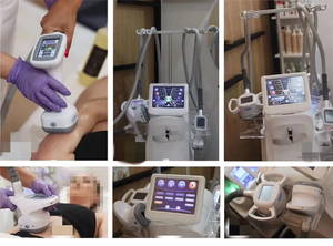 Máquina de Adelgazamiento Corporal 4 en 1 con Rodillo de Vacío, Eliminación de Celulitis, Reafirmación de la Piel, Limpieza Facial, Lifting, Equipo de Salón Velaslim - Product Image 4