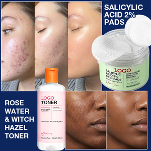 Set de Cuidado Facial de 3 Pasos con Ácido Salicílico al 2% para Control de Grasa, Reducción de Poros, Exfoliación, Tratamiento para el Acné y Calmante para Piel Propensa a Imperfecciones - Product Image 3