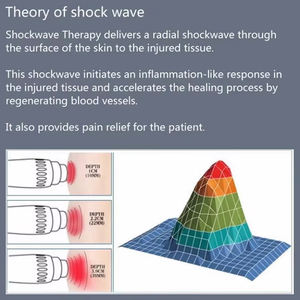 Mesin terapi Shock Wave, peralatan fisioterapi terapi <span class=keywords><strong>Ultrasound</strong></span> fisik anti guncangan gelombang - Product Image 4