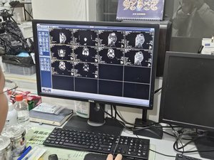 Système d'imagerie médicale radiologique pour animaux de compagnie EUR VET, réutilisable, en forme de C, 0,35T, pour scanner IRM en milieu hospitalier - Product Image 6