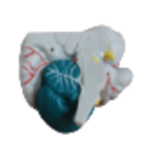 ADA Science médicale Le modèle anatomique du cerveau et le modèle de l'artère cérébrale pour la démonstration de la maladie Outil d'enseignement médical - Product Image 4