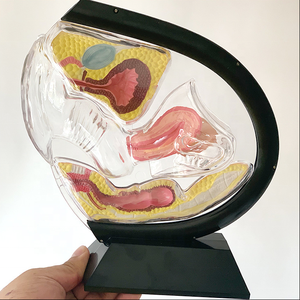 Modelo Anatómico Uterino Transparente Visible, Material Ecológico, Estándar Europeo, Pintura Avanzada No Tóxica, Vic Science Medical - Product Image 1