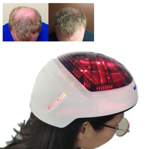 KN-8000B Kernel Salon klinik menggunakan 510K CE diakui 650nm dioda <span class=keywords><strong>Laser</strong></span> hijau kekayaan neo rambut lotion terapi <span class=keywords><strong>laser</strong></span> tingkat rendah medis - Product Image 5