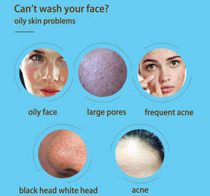 Loción Herbal para la Piel con Ácido Salicílico y Aceite de Árbol de Té, Crema Anti-Acné para Cicatrices de Acné, Pápulas y Manchas Negras en el Rostro - Product Image 6