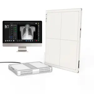 Best Iray Mars 1417V X Ray Medical Digital Dr Wireless Digital Flat Panel Detector For Hospital