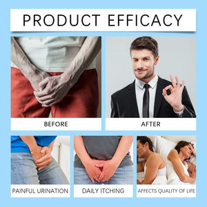 2025 Repleto con extractos de caléndula Ideal para la recuperación muscular después del ejercicio Crema para la salud de la próstata Cuidado corporal - Product Image 5