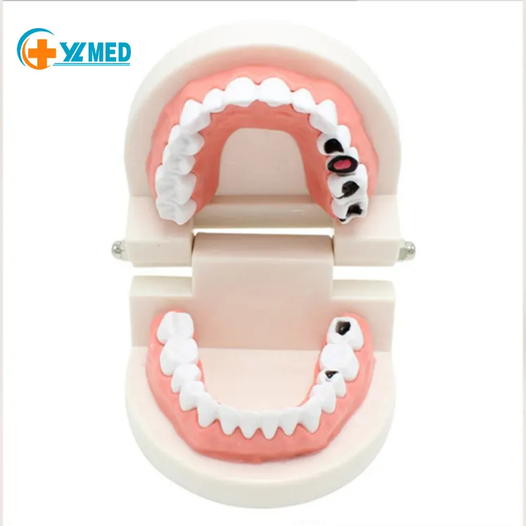 Scienza medica di alta qualità modello di dente orale piccolo modello di igiene dentale per l'insegnamento educativo Qquipment