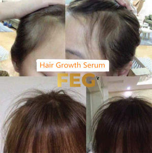 Spray para el Crecimiento del Cabello con Tu Propia Marca, Producto en Oferta, Botella OEM, Detiene la Caída del Cabello en 7 Días - Product Image 6