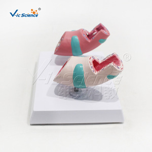 Suministro directo de fábrica de modelos de patología traqueal, hechos de material de PVC ecológico, claramente identificados, para laboratorio. - Product Image 4