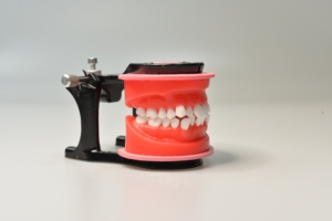 Modèle de typodont dentaire ciré pour orthodontie, pratique orthodontique - Product Image 3