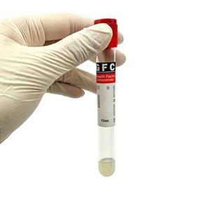 Tubo de Ensayo GFC de 10 ml y 12 ml, Venta Caliente de Fábrica, Utilizado para los Departamentos de Odontología y Cosmética - Product Image 4