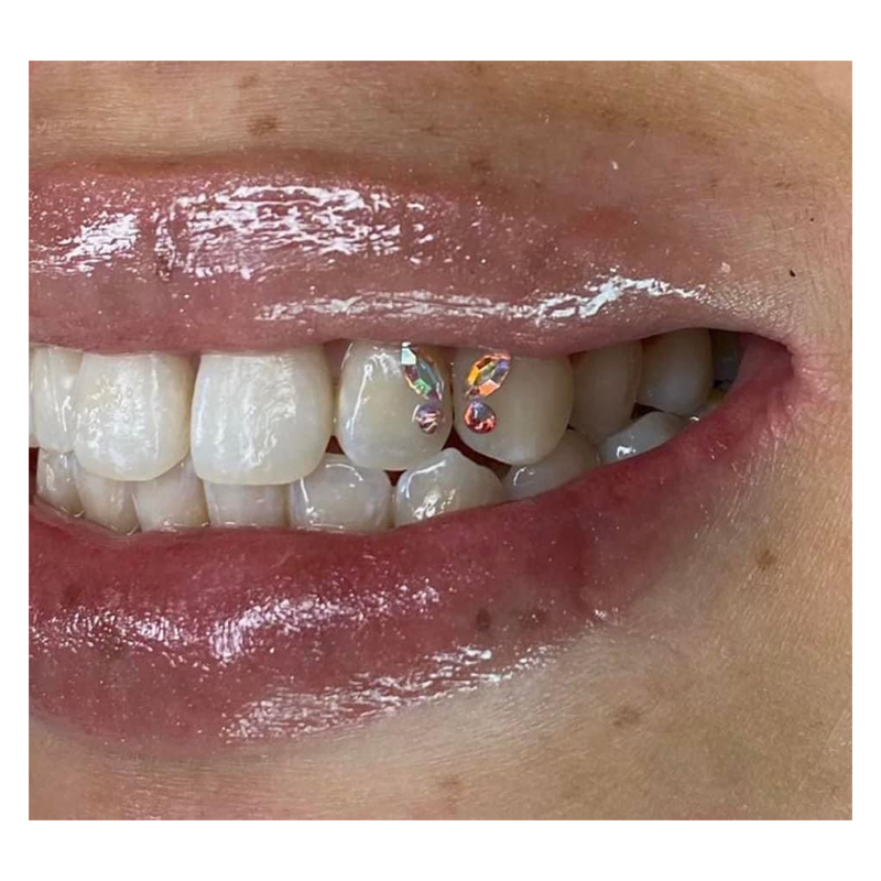 3D クリスタル　歯 Sc19743df2bfa402185082d7dcffde