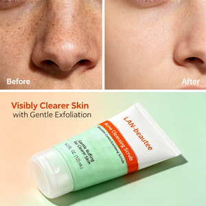 <span class=keywords><strong>Gommage</strong></span> Visage en Gros : Réduit les Taches Brunes et l'Acné, Exfolie Doucement, Améliore la Texture de la <span class=keywords><strong>Peau</strong></span> - Product Image 4