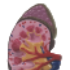 Modelo de anatomía renal ADA Medical Science con modelo de glándula suprarrenal U022C/U022D, origen Shanghái, para entrenamiento y demostración de enfermedades - Product Image 5