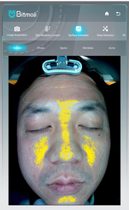 Scanner Facciale AI Portatile da 13,3 Pollici con Funzioni Estetiche, Analizzatore Cutaneo 3D per Bellezza Corporea, Spina EU/JP/US - Product Image 5