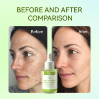 Suero Blanqueador con Ácido Kójico OEM 30ml, Aclarante Facial Natural con Cúrcuma en Botella de Vidrio con Gotero, Marca Privada para Cuidado de la Piel