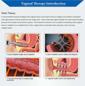 Máquina de Láser Fraccional de CO2 con Tubo de RF, Tubo de Vidrio de 10600nm y 60W para Tensado Vaginal, Eliminación de Cicatrices, Salón de Belleza, Venta al por Mayor - Product Image 5