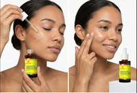 Sérum à l'acide tranexamique et à la niacinamide pour estomper les taches, unifier le teint, éclaircir les décolorations, 30 ml, OEM, ODM, étiquette privée, logo personnalisé, vente en gros