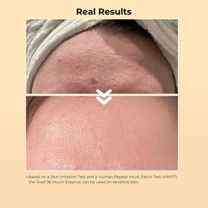 IXen rivrivate Abel 100 Moioisturizing nnti Ging mmfies mnail kin are et vanced Sclavo 96 ucucin cortacésped ssssence nail clavo erum - Product Image 6