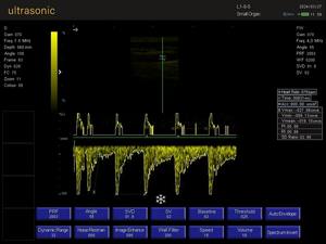Ecógrafo Portátil para Mascotas, Perros y Gatos, KT-A028 - Product Image 6
