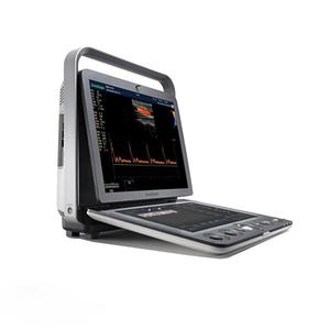 Appareil d'échographie vétérinaire portable Sonoscape S9Vet avec écran tactile haute résolution de 13,3 pouces, garantie de 2 ans - Product Image 2