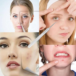 Pince à épiler professionnelle en acier inoxydable, pointe ultra-fine de précision, pour l'élimination des points noirs, des comédons, de l'acné, des boutons et des poils incarnés - Product Image 6