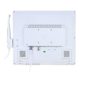 Système de caméra intra-orale dentaire Meiliguang M-978 de 17 pouces avec scanner de code QR Wi-Fi et moniteur d'imagerie médicale - Product Image 2