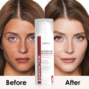 Crème double blanchissante pour le visage Crème professionnelle éclaircissante pour la peau au niacinamide pour le visage et le cou Crème de soin - Product Image 3