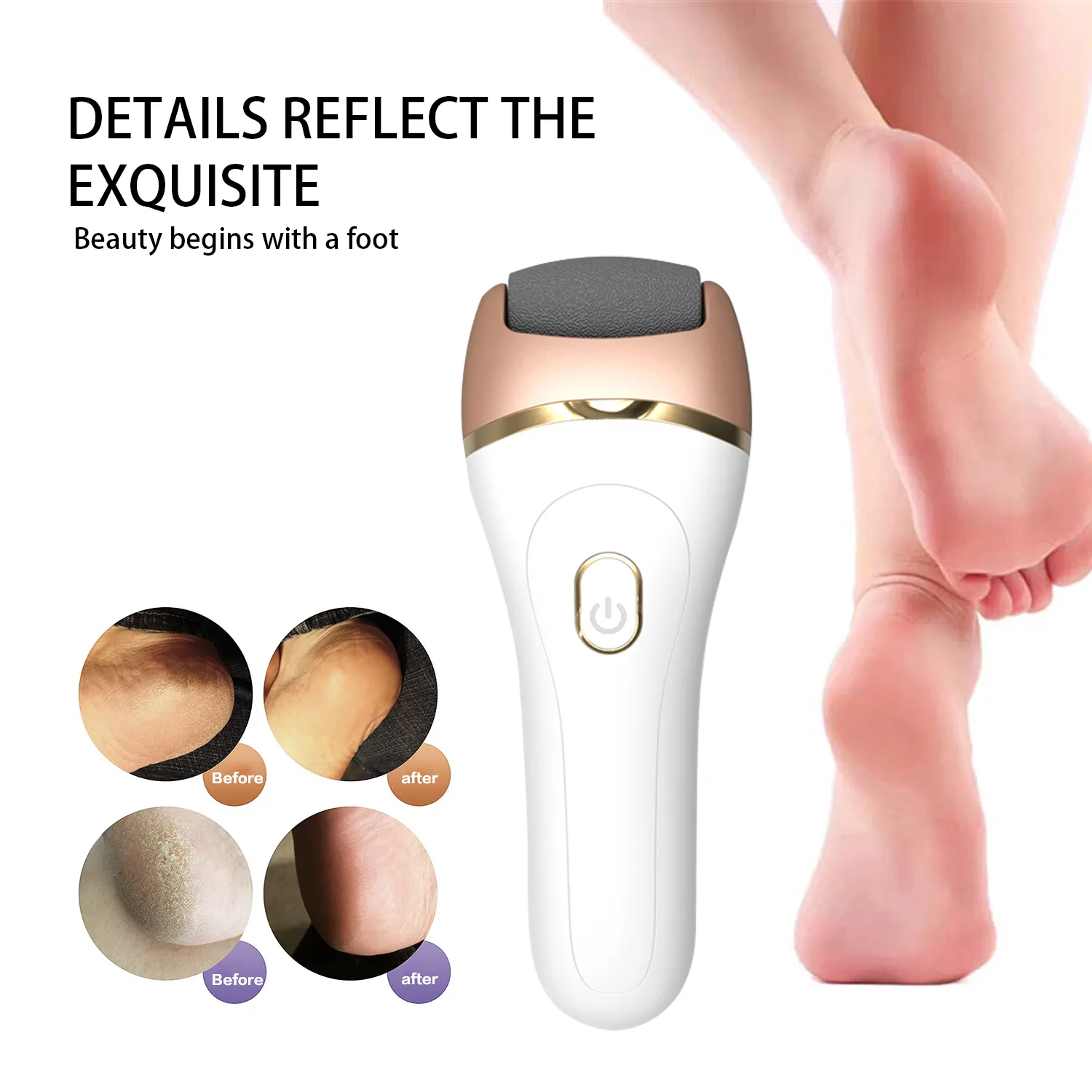 Rechargeable Best Selling Callus Scrubber in USA Electronic Pedicure Foot File Calluses Powerful Electric Foot Hard Skin Remover