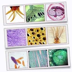 Ensemble fixe de HYEDU 25 pièces <span class=keywords><strong>entomologie</strong></span> insectes microscope préparé spécimen diapositives - Product Image 5