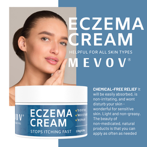 Crema para Eczema y Psoriasis de Marca Privada con Glicerina para Hidratar, Reducir el Enrojecimiento, Efectos <span class=keywords><strong>Antiinflamatorios</strong></span> y Nutritivos - Product Image 5