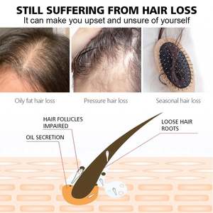 Suero para el crecimiento del cabello de Etiqueta Privada, efecto refrescante anticaspa rápido, extracto de jengibre vegano Panax Ginseng, nutre las raíces del cabello - Product Image 4