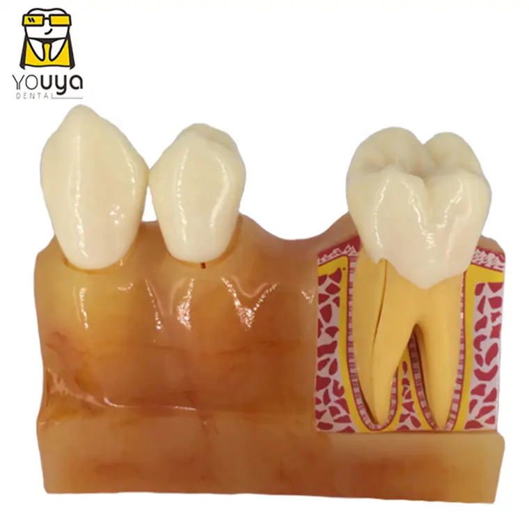 نموذج تعليمية للأسنان ولب الأسنان ونموذج الفم الشرجي