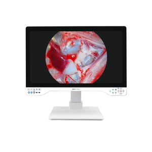 Прямая 32-дюймовая система эндоскопической камеры 4K для эндоскопической урологии и лапароскопии от производителя - Product Image 2