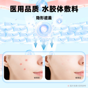 Chenkang Hydrocolloid Acne Patches Round Invisible Face Treatment Medical Grade - Product Image 1