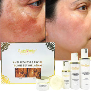 Özel etiket Anti kızarıklık ve yüz yanıkları seti vitamin C aydınlatma cilt seti ile melazma ve hiperpigmentasyon kaldırmak - Product Image 5