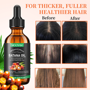 <span class=keywords><strong>Aceite</strong></span> de Romero, Jengibre, Ricino y Almendras 100% Natural y Orgánico de Marca Privada para el Cuidado del Cuero Cabelludo, Tratamiento Capilar y Crecimiento del Cabello para Hombres y Mujeres - Product Image 4