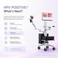 Colposcope vidéo numérique haute définition Kernel GN-500 pour le dépistage de la néoplasie cervicale et l'évaluation clinique gynécologique