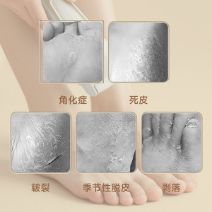 เครื่องตะไบเท้าไฟฟ้า Zhaiqing รุ่น V902 สีขาวดำ พร้อมกระดาษทราย สำหรับใช้ในบ้าน กันน้ำ หน้าจอดิจิตอล กำจัดหนังด้าน - Product Image 2