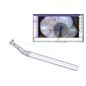 Micro caméra orale haute définition Micro caméra visuelle à lentille pour le traitement du canal radiculaire - Product Image 1