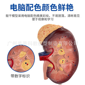 Modèle d'enseignement d'anatomie rénale grossi 2x, modèle réduit d'anatomie rénale humaine normale, avec glande surénalette - Product Image 5