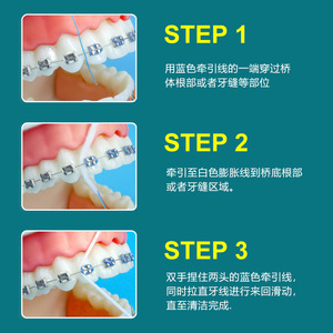 Fil dentaire orthodontique en rouleau de 50 mètres, fil moelleux, portable, pour le nettoyage interdentaire - Product Image 1