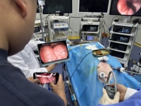 Système de caméra endoscopique sans fil 4K avec transmission Wi-Fi, affichage via application et faible latence pour ORL, cystoscope et urétéroscope