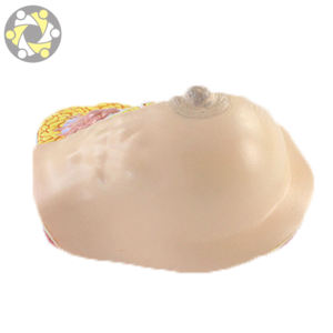 Modèle anatomique du <span class=keywords><strong>cancer</strong></span> du sein féminin dans la section transversale modèle de médecine du sein pathologique - Product Image 4