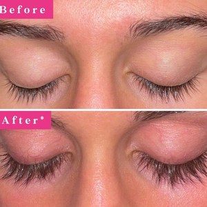 Suero Avanzado para Pestañas, para Pestañas Más Largas y Voluminosas, Hidratante, Fortalece las Raíces de las Pestañas, Suero para Pestañas, Maquillaje de Ojos para Mujer - Product Image 4