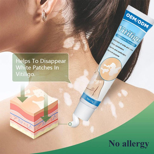 Pommade réparatrice cutanée localisée d'usine OEM pour le traitement des taches blanches, du vitiligo, du <span class=keywords><strong>psoriasis</strong></span> et de la leucoplasie – Fourniture de santé - Product Image 3
