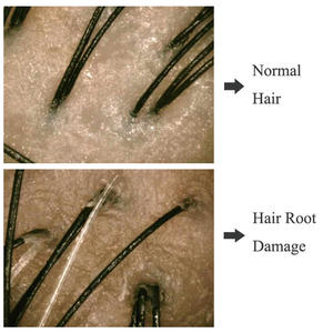 Dermatoscope Analyseur de Peau Analyseur de Composition Corporelle <span class=keywords><strong>Machine</strong></span> de Dialyse à Vendre - Product Image 3